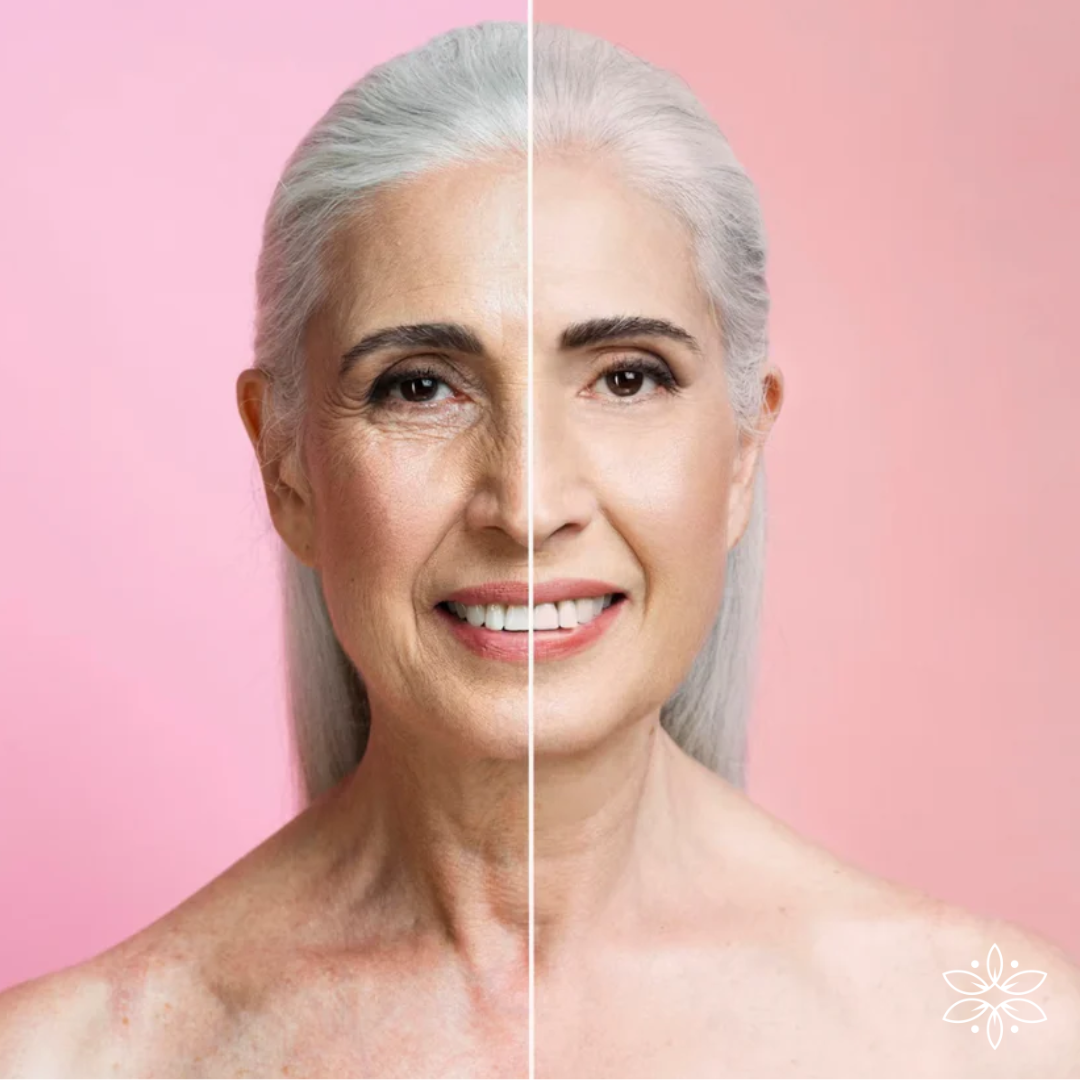 FULLORIA Bioestimuladores